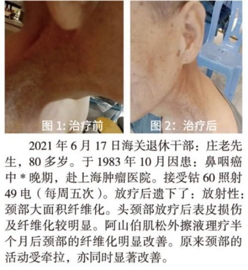 千年智慧与现代科学的抗癌新纪元: 何金山的破壁之路